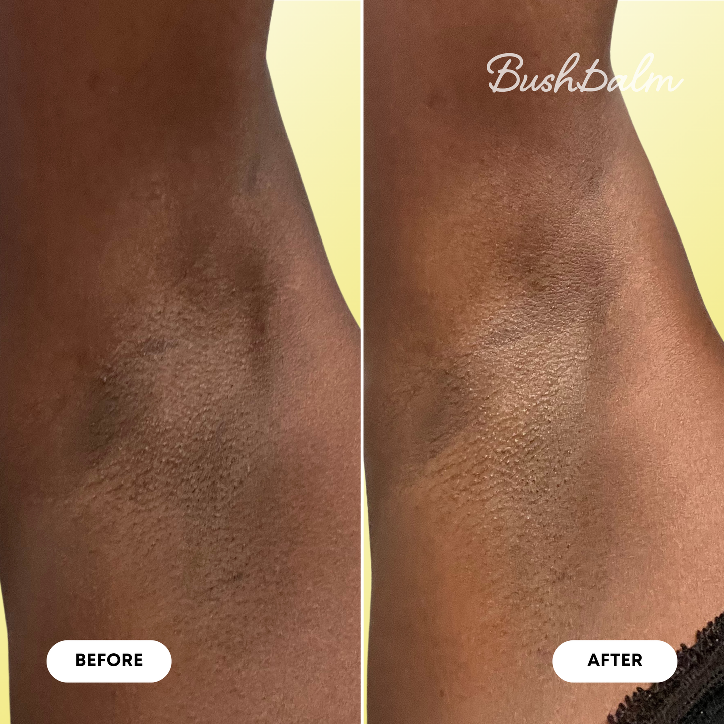 Mini Dark Spot Oil