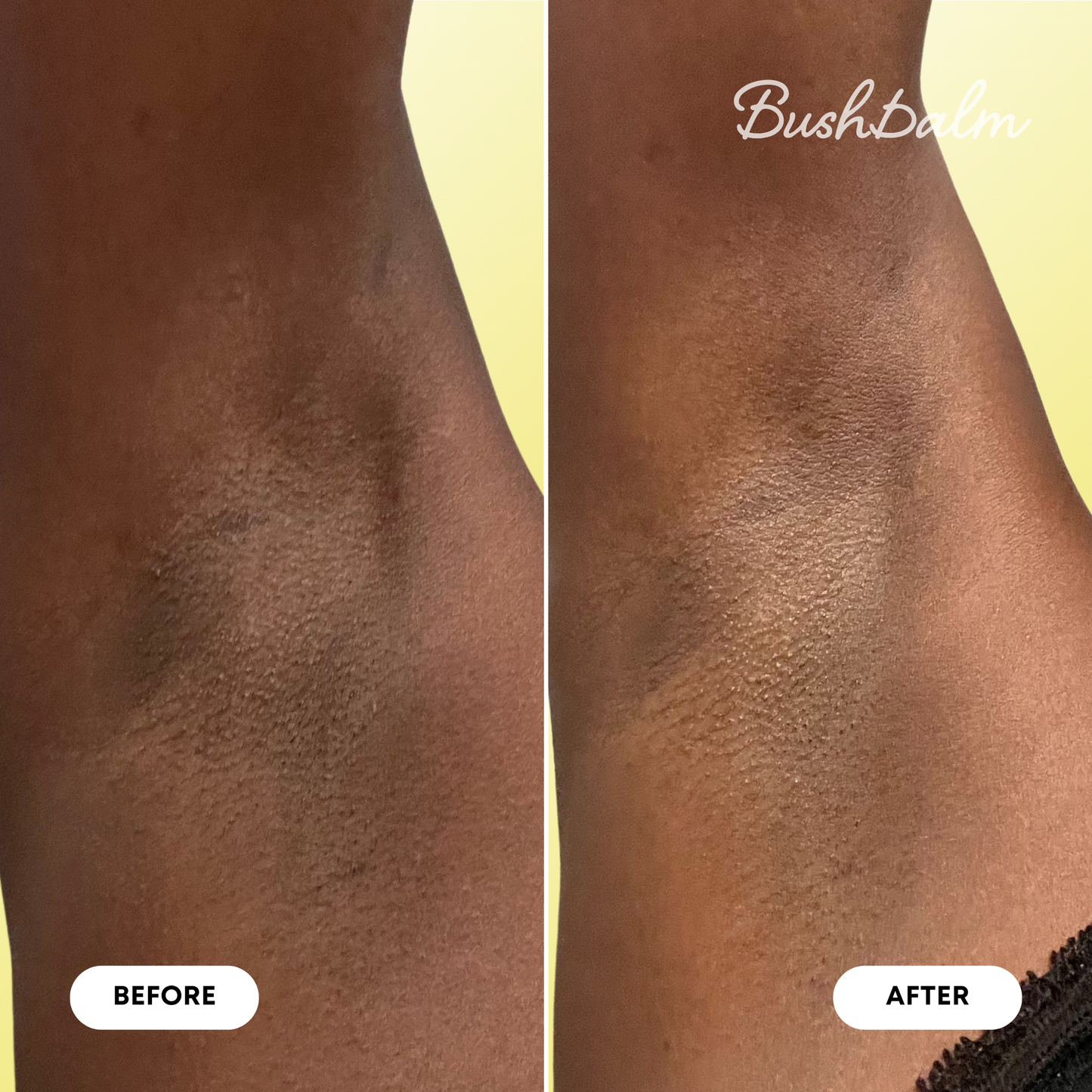 Dark Spot Oil
