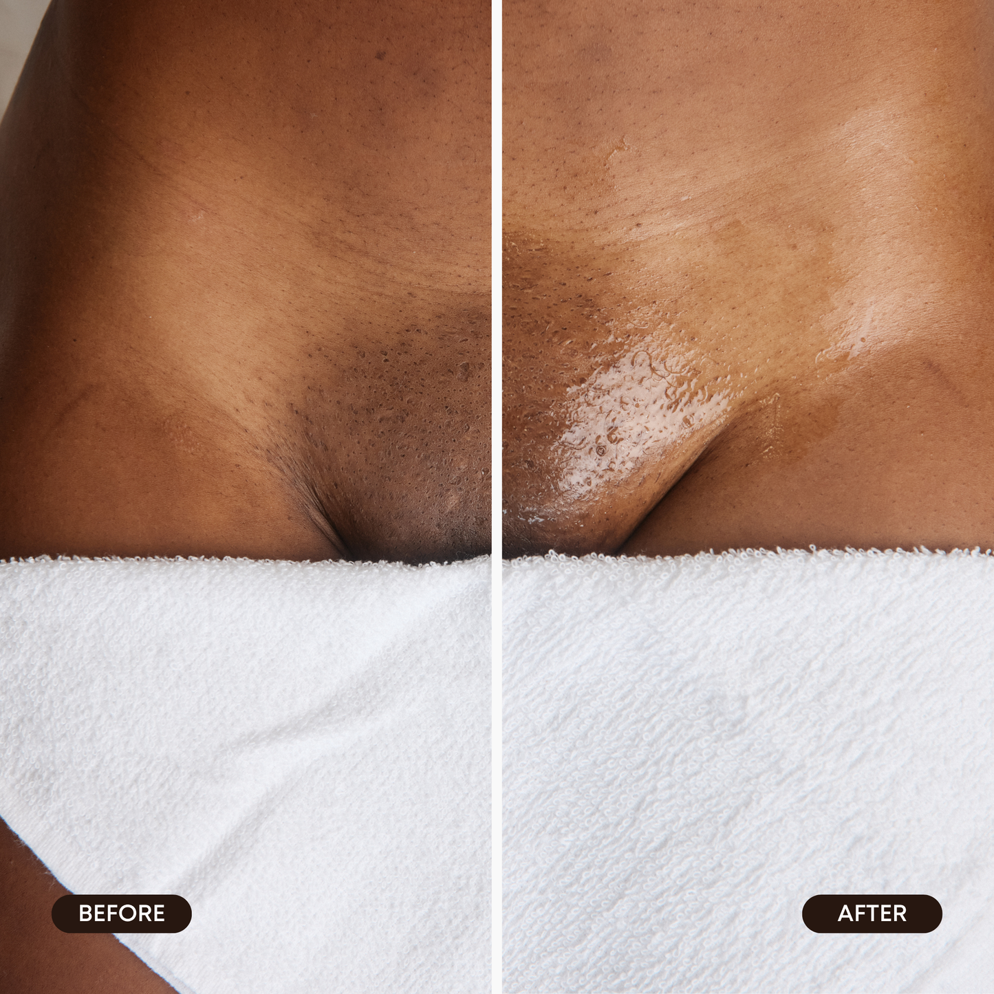 Brightening Hydrogel Vajacial Side Strip Mask