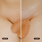 Hydrogel Vajacial Side Strip Mask