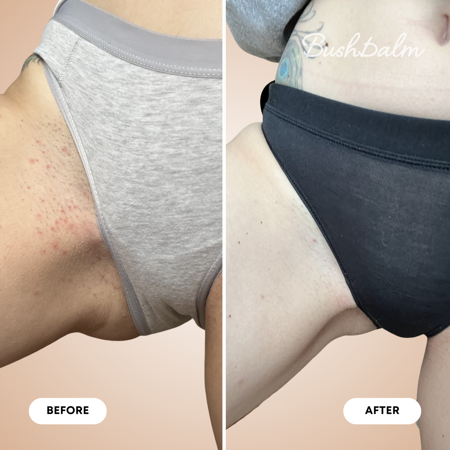 Ingrown Hair Exfoliating Body Scrub