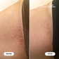 Mini Ingrown Hair Oil