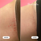 Ingrown Hair Pre/Post Wax Oil