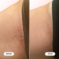 Ingrown Hair Pre/Post-Wax Oil