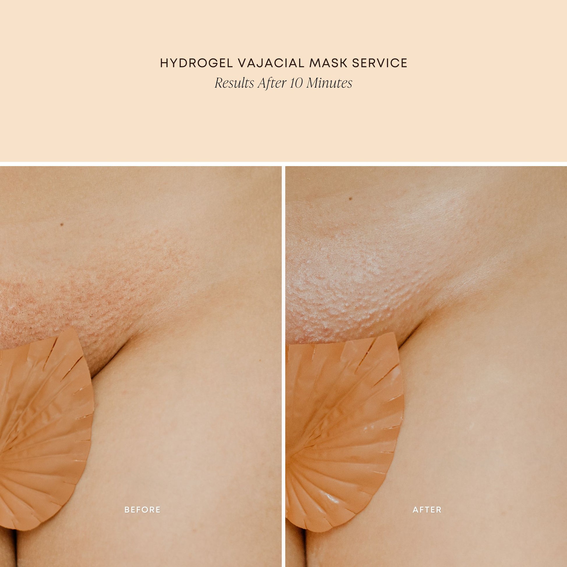 Full Hydrogel Vajacial Set
